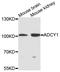 Adenylate Cyclase 1 antibody, A9760, ABclonal Technology, Western Blot image 