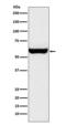 Monoamine Oxidase A antibody, M03326-1, Boster Biological Technology, Western Blot image 