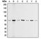 Akt antibody, LS-C351852, Lifespan Biosciences, Western Blot image 