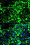 Tropomyosin 1 antibody, LS-B13854, Lifespan Biosciences, Immunofluorescence image 