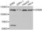 Glutamate Metabotropic Receptor 8 antibody, abx002157, Abbexa, Western Blot image 
