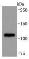 ADAM Metallopeptidase Domain 17 antibody, A00604-3, Boster Biological Technology, Western Blot image 