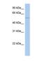 Chitobiosyldiphosphodolichol beta-mannosyltransferase antibody, NBP1-69510, Novus Biologicals, Western Blot image 