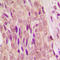 SMAD Family Member 4 antibody, LS-C352478, Lifespan Biosciences, Immunohistochemistry paraffin image 