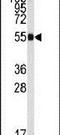 Aldehyde Dehydrogenase 9 Family Member A1 antibody, PA5-15006, Invitrogen Antibodies, Western Blot image 