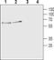 Solute Carrier Family 18 Member A3 antibody, PA5-77386, Invitrogen Antibodies, Western Blot image 