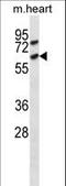 Activin A Receptor Type 1C antibody, LS-C164286, Lifespan Biosciences, Western Blot image 