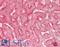 STEAP3 Metalloreductase antibody, LS-B13356, Lifespan Biosciences, Immunohistochemistry paraffin image 
