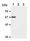 Checkpoint Kinase 2 antibody, LS-C343638, Lifespan Biosciences, Western Blot image 