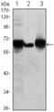 Alkaline Phosphatase, Placental antibody, abx011923, Abbexa, Enzyme Linked Immunosorbent Assay image 