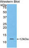 Laminin Subunit Beta 2 antibody, LS-C299455, Lifespan Biosciences, Western Blot image 