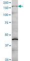 Collagen Type V Alpha 1 Chain antibody, H00001289-M01, Novus Biologicals, Western Blot image 