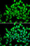 Alsin Rho Guanine Nucleotide Exchange Factor ALS2 antibody, STJ29205, St John