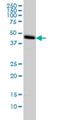 Core 1 Synthase, Glycoprotein-N-Acetylgalactosamine 3-Beta-Galactosyltransferase 1 antibody, H00056913-M01, Novus Biologicals, Western Blot image 