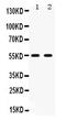 5-Hydroxytryptamine Receptor 2B antibody, PB9600, Boster Biological Technology, Western Blot image 