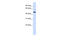 Tubby protein homolog antibody, 27-113, ProSci, Western Blot image 