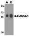 Aldehyde Dehydrogenase 5 Family Member A1 antibody, A03802, Boster Biological Technology, Western Blot image 