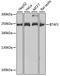 B-TFIID TATA-Box Binding Protein Associated Factor 1 antibody, STJ28374, St John