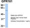 G Protein-Coupled Receptor 161 antibody, TA346460, Origene, Western Blot image 
