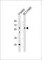 General Transcription Factor IIA Subunit 1 Like antibody, 57-690, ProSci, Western Blot image 
