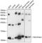 NDUFA4 Mitochondrial Complex Associated Like 2 antibody, GTX66244, GeneTex, Western Blot image 