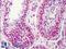 NIMA Related Kinase 2 antibody, LS-B129, Lifespan Biosciences, Immunohistochemistry frozen image 