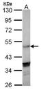 Nuclear Receptor Subfamily 1 Group H Member 3 antibody, GTX106380, GeneTex, Western Blot image 