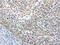 Ubiquitin C-terminal hydrolase UCH37 antibody, CSB-PA561195, Cusabio, Immunohistochemistry paraffin image 