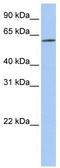 Solute Carrier Family 22 Member 14 antibody, TA333960, Origene, Western Blot image 