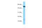 Cornifin-B antibody, ARP63557_P050, Aviva Systems Biology, Western Blot image 