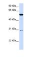 Autoimmune Regulator antibody, orb329632, Biorbyt, Western Blot image 