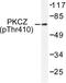 Protein Kinase C Zeta antibody, LS-C177941, Lifespan Biosciences, Western Blot image 