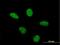 Lysine Acetyltransferase 2B antibody, H00008850-M06, Novus Biologicals, Immunofluorescence image 