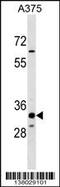 Thioesterase Superfamily Member 5 antibody, 59-477, ProSci, Western Blot image 