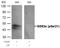 Glycogen Synthase Kinase 3 Alpha antibody, GTX50095, GeneTex, Western Blot image 