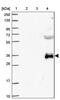 Globoside Alpha-1,3-N-Acetylgalactosaminyltransferase 1 (FORS Blood Group) antibody, PA5-62371, Invitrogen Antibodies, Western Blot image 