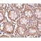 CD248 Molecule antibody, LS-C53213, Lifespan Biosciences, Immunohistochemistry frozen image 