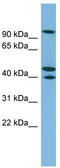 Exocyst Complex Component 5 antibody, TA340118, Origene, Western Blot image 
