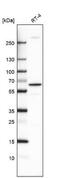 MYCL Proto-Oncogene, BHLH Transcription Factor antibody, NBP2-55735, Novus Biologicals, Western Blot image 