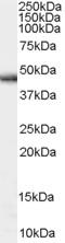 Parkin RBR E3 Ubiquitin Protein Ligase antibody, EB07439, Everest Biotech, Western Blot image 