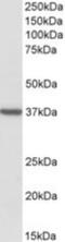 Translocase Of Outer Mitochondrial Membrane 40 antibody, NBP1-51997, Novus Biologicals, Western Blot image 