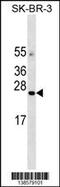 Angiotensin II Receptor Associated Protein antibody, 59-887, ProSci, Western Blot image 