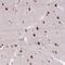 Zinc Finger Protein 672 antibody, PA5-63177, Invitrogen Antibodies, Immunohistochemistry frozen image 