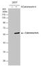 Protein Phosphatase 3 Catalytic Subunit Alpha antibody, GTX111207, GeneTex, Western Blot image 