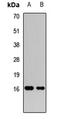 Fibroblast Growth Factor 21 antibody, LS-C668805, Lifespan Biosciences, Western Blot image 