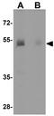 Karyopherin Subunit Alpha 7 antibody, GTX31991, GeneTex, Western Blot image 