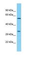 Phosphatidylinositol Specific Phospholipase C X Domain Containing 3 antibody, orb327078, Biorbyt, Western Blot image 