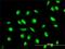 Mitogen-Activated Protein Kinase Kinase 6 antibody, H00005608-M02, Novus Biologicals, Immunofluorescence image 