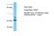 Signal Sequence Receptor Subunit 1 antibody, A30302, Boster Biological Technology, Western Blot image 