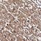 Kinesin Family Member 1C antibody, NBP2-48824, Novus Biologicals, Immunohistochemistry paraffin image 